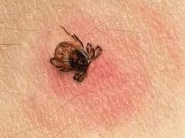 How to Prevent Zoonotic Diseases Caused by Pests